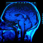 What You Need to Know About Traumatic Brain Injury Claims 4
